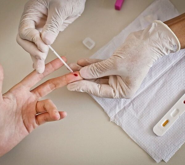 Mais de 95% das UBSs do Distrito Federal oferecem testes…