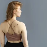 Dezembro Laranja e o câncer mais comum no Brasil; entenda