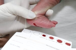 Diagnóstico precoce pelo Teste do Pezinho transforma a vida de crianças com doenças raras
