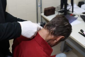 Botox oferecido pelo SUS ajuda pacientes a recuperar movimentos e qualidade de vida