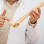 Excesso de suplementos pode prejudicar a saúde óssea, aponta estudo